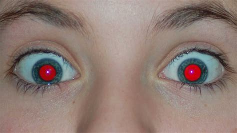 ojos rojos